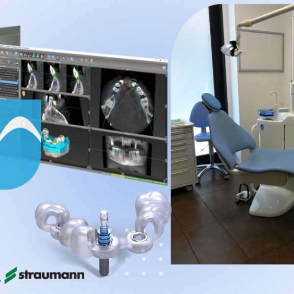 Chirurgia guidata Straumann a Marsciano: implantologia digitale di precisione per tornare a sorridere