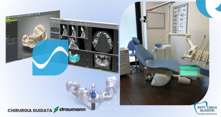 Chirurgia guidata Straumann a Marsciano: implantologia digitale di precisione per tornare a sorridere